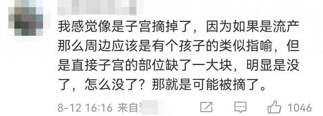 韩素希黑暗荣耀